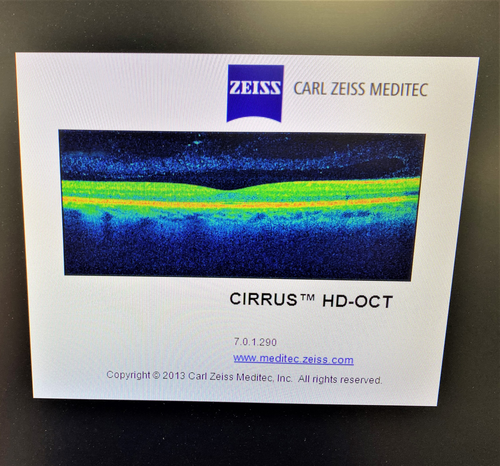 "VERKAUFT" OCT Zeiss Cirrus HD 500 aus 2014; Inv.G20471C