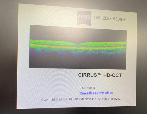 "VERKAUFT" OCT Zeiss Cirrus HD 500 Inv.G20475C