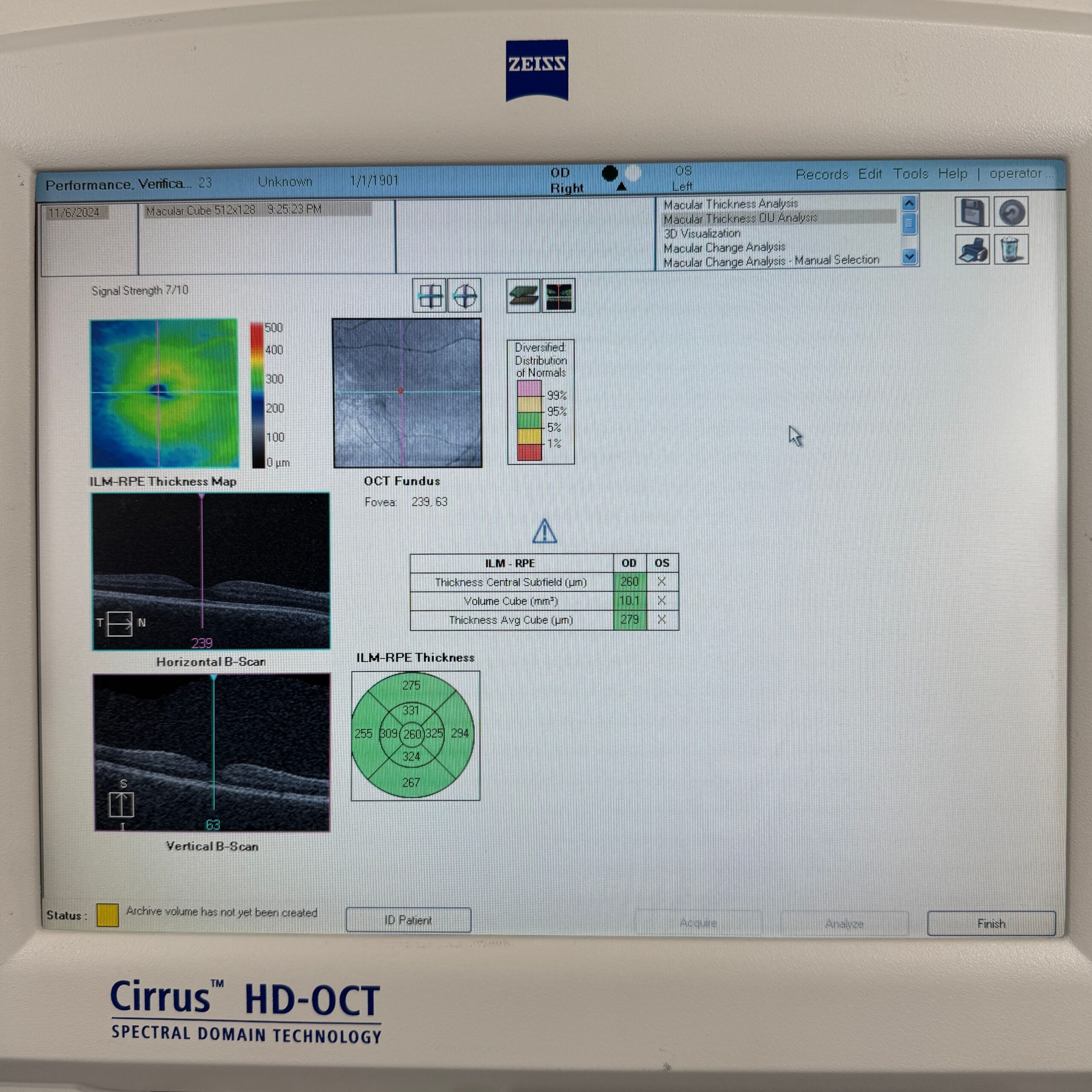 OCT Zeiss Cirrus 400 (g9017) – Bild 8
