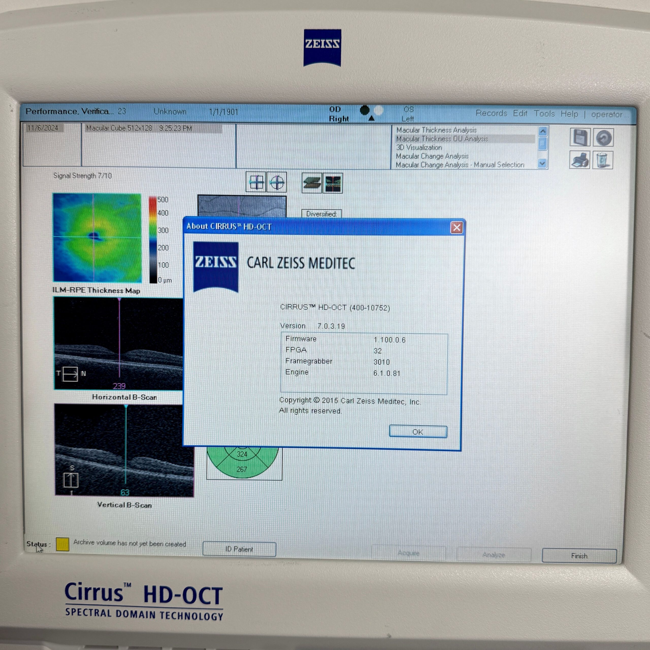 OCT Zeiss Cirrus 400 (g9017) – Bild 5