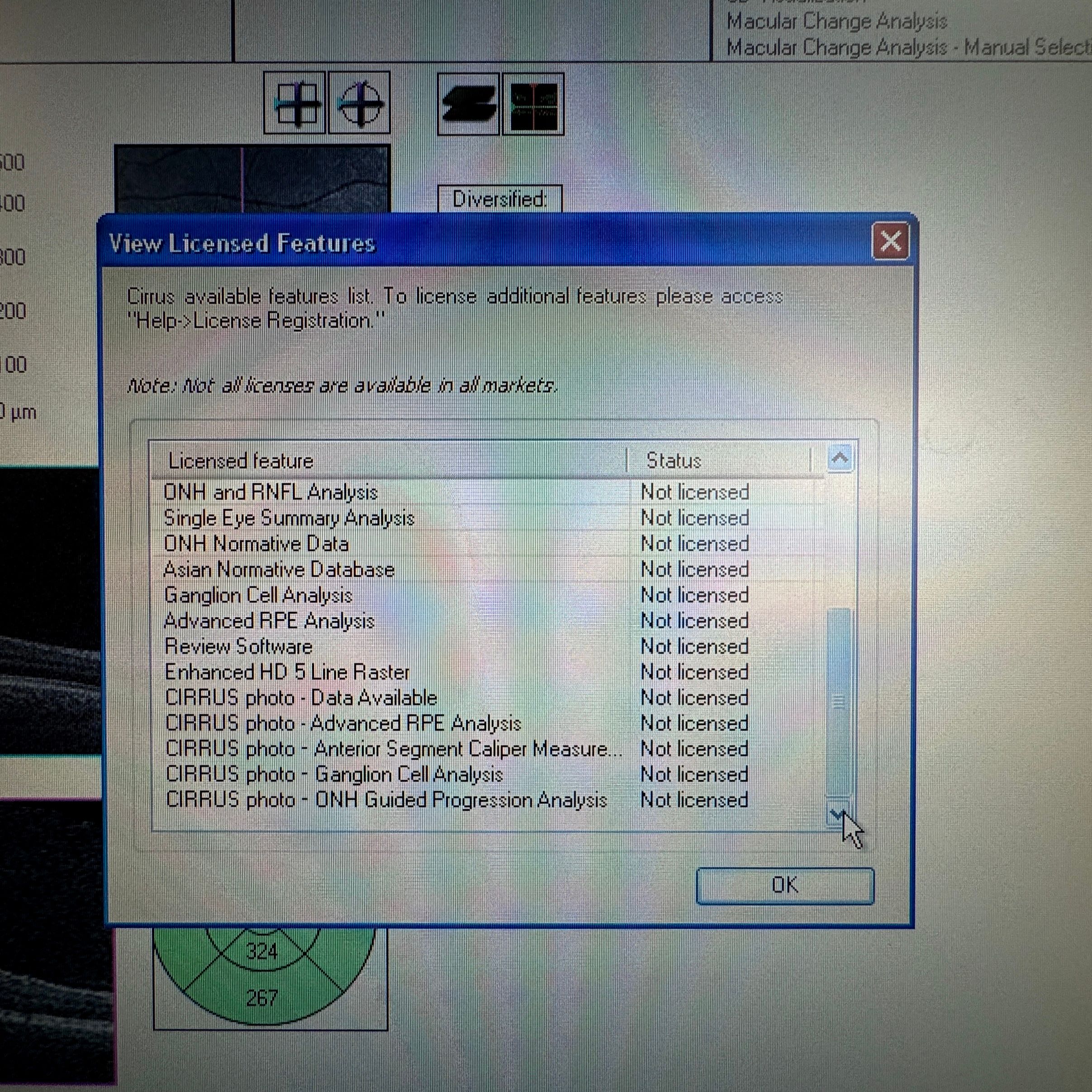 OCT Zeiss Cirrus 400 (g9017) – Bild 3