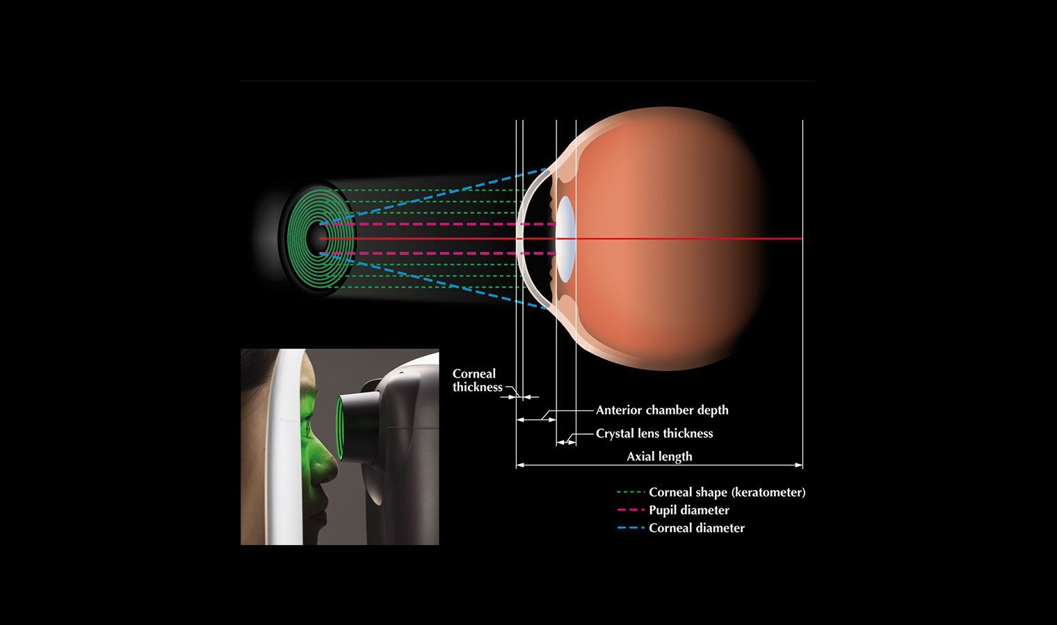 Optisches Biometer Tomey OA 2000 – Bild 3